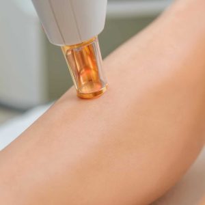 Partial view of woman receiving laser treatment on leg